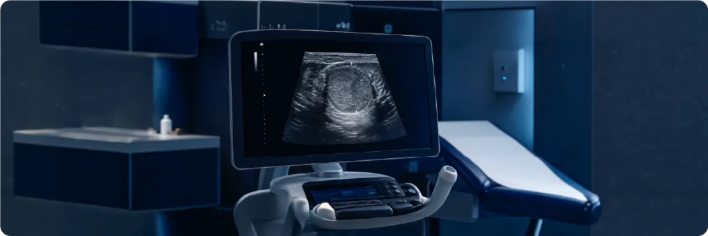 Câncer de testículo: causas, autoexame e tratamento com taxa de cura acima de 95% – urologista Dr. Jean Datovo em Bragança Paulista e Cambuí MG 5 cancer de testiculo causas autoexame e tratamento com taxa de cura acima de 95 urologista dr jean datovo em braganca paulista e cambui mg