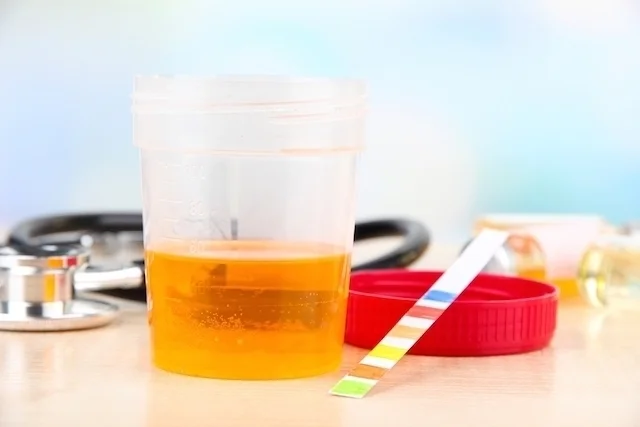 Sangue na urina é sinal de alerta 4 sangue na urina e sinal de alerta 2